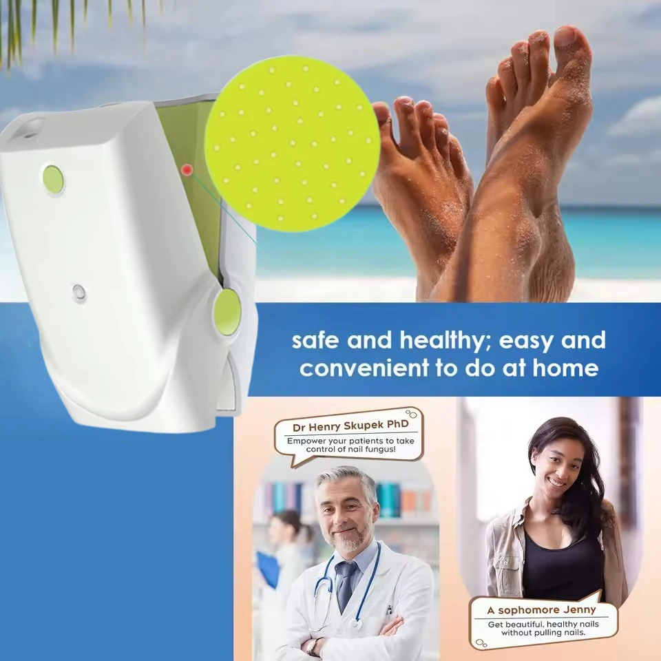 Laser Nail Fungus Remover - Professional Onychomycosis Treatment Device for Healthy Nails