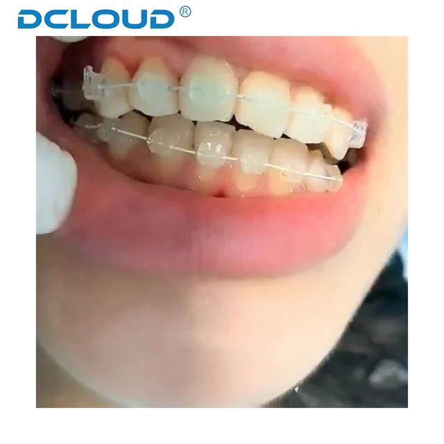 5 Confezioni Filo Arco Rettangolare Dentale Ortodontico - Foto 6