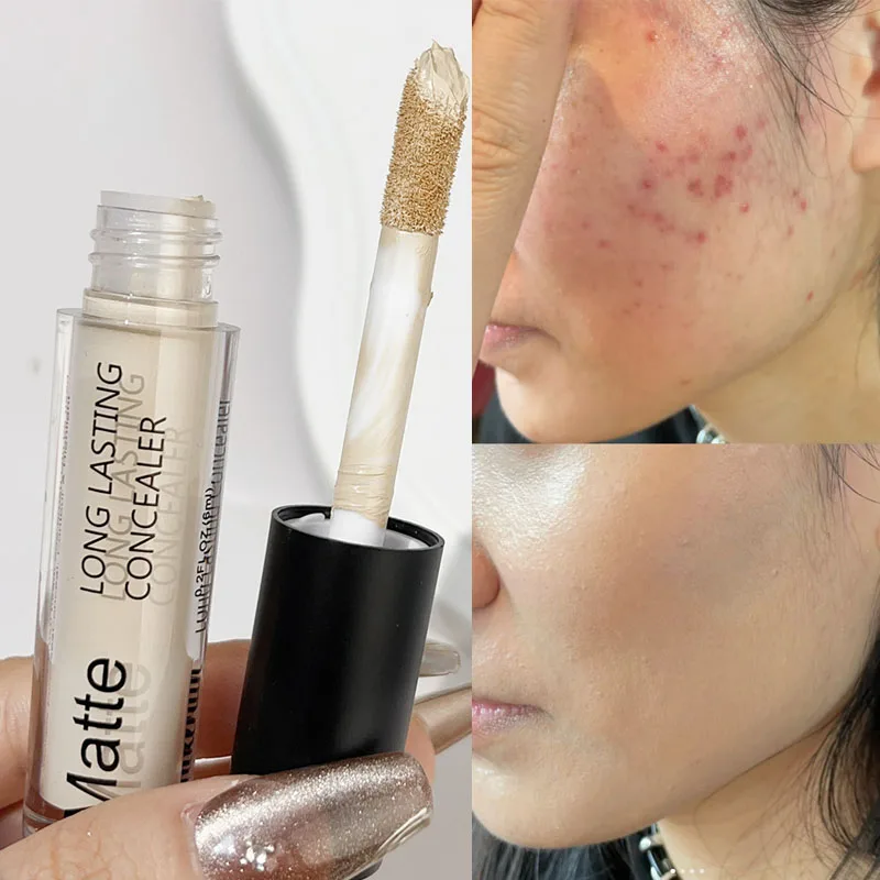 Face Concealer Foundation Makeup Cover Acne Spot Dark Circles