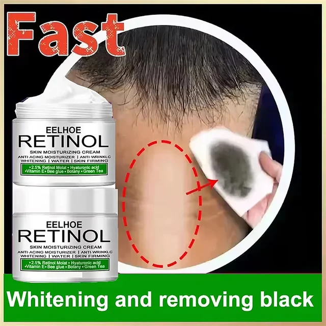 Intimate Whitening Cream – Brighten & Smooth Skin