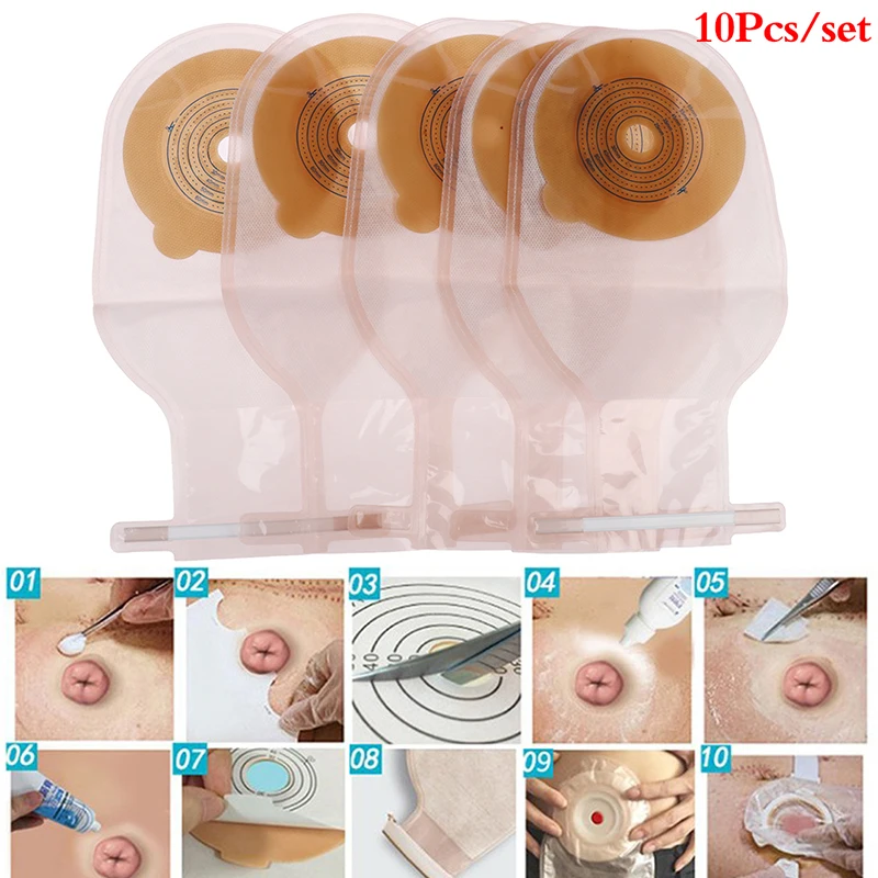 Colostomy Bags 10Pcs 25-60mm Stoma Pouch One-piece Open Clip Ostomy
