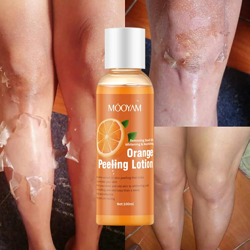 

100ML Orange Peeling Lotion Body Care Skin Whitening Cream Oil Organic Lotion for Removing Dead Skin Exfoliating Gel