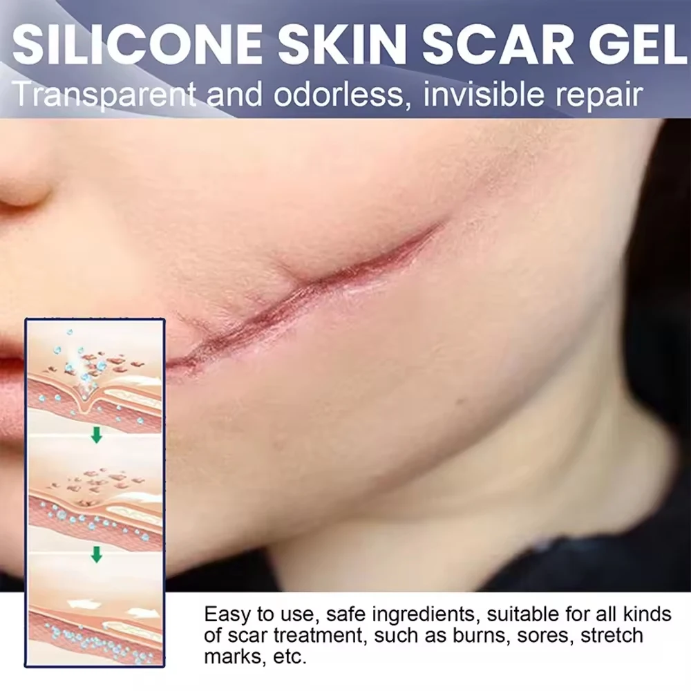 Scar Repair Gel Pen Treatment Improve Keloid Stretch Mark Whitening Body Care