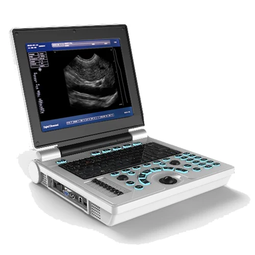 

High Quality XF30B Full Digital Laptop Portable Buy Machines Ultrasound Scanner Price