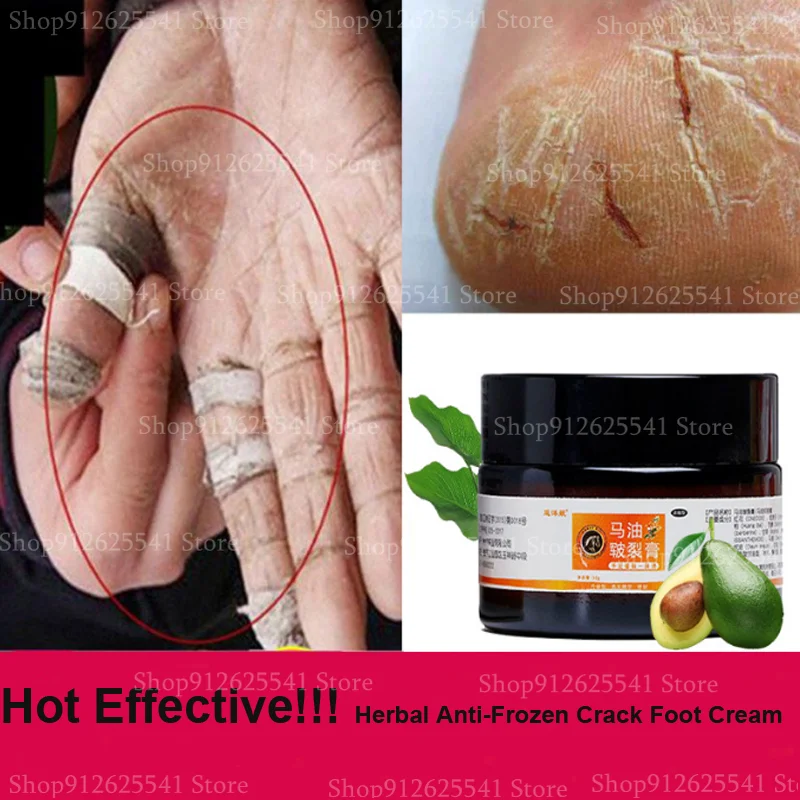 30g Horse Oil Chapped Cream Anti-Frozen Crack Foot Cream Heel Cream Hand Cream Hydrating Exfoliating Remove Calluses Anti-drying