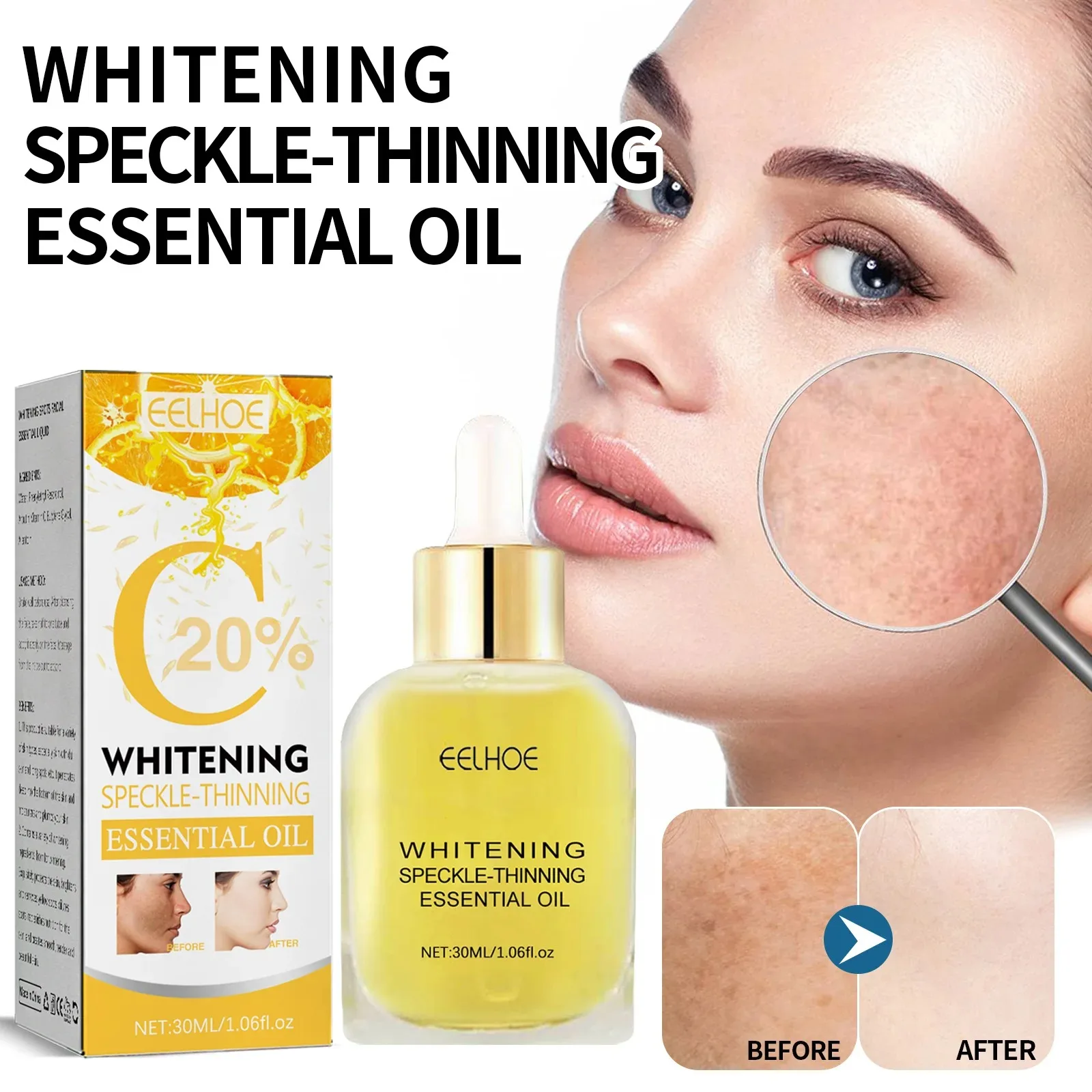 Vitamin C Whitening Serum Face Freckle Remover Fade Dark Spot Pigment Melanin Corrector Brightening Skin Whitening Serum Female_voghion.com