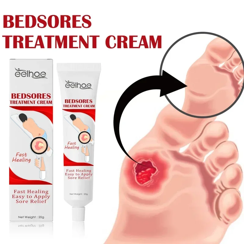 Decubitus Cream Pressure Sore Ulcer Skin Relief Ointment Bed Sore Wound Healing Treat Anti Dry Repair Moisturizing Body Care sore healing cream