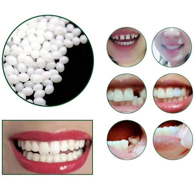 Temporary Tooth Repair Kit Teeth And Gaps FalseTeeth Solid Glue Dentur