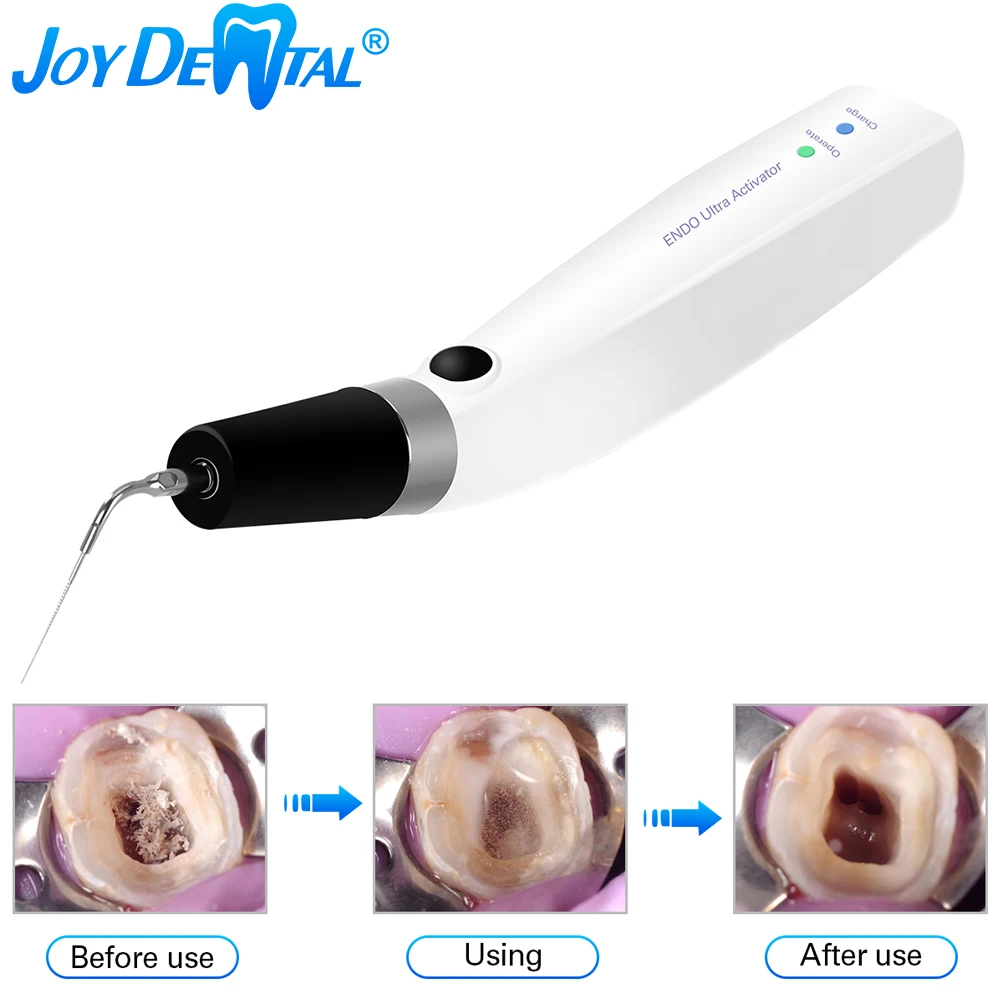 

Dental Endo Activator Wireless Ultra Sonic Irrigator for Endo Root Canal With 6pcs Tips Endodontic Cleaning Instrument