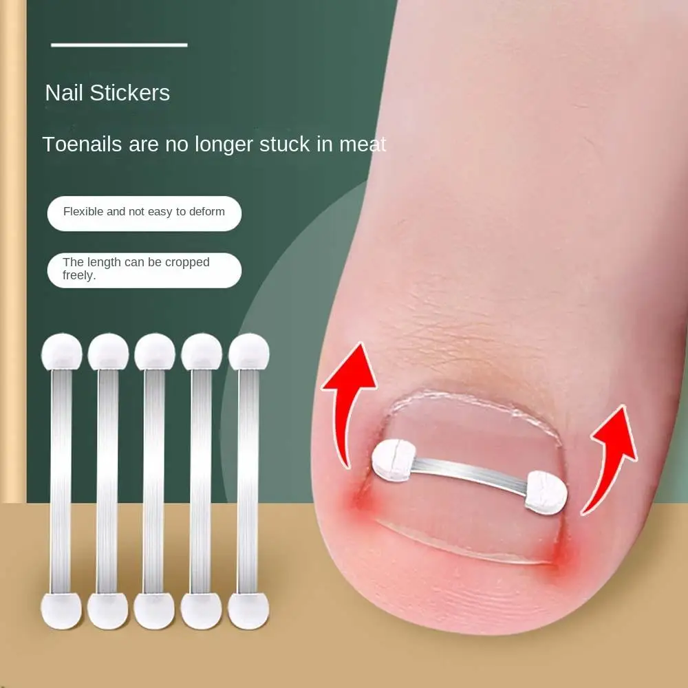

Toe Splint Support Pedicure Tool Toe Braces Toenail Fixer Bunion Corrector Ingrown Toenails Corrector Toenail Straightener