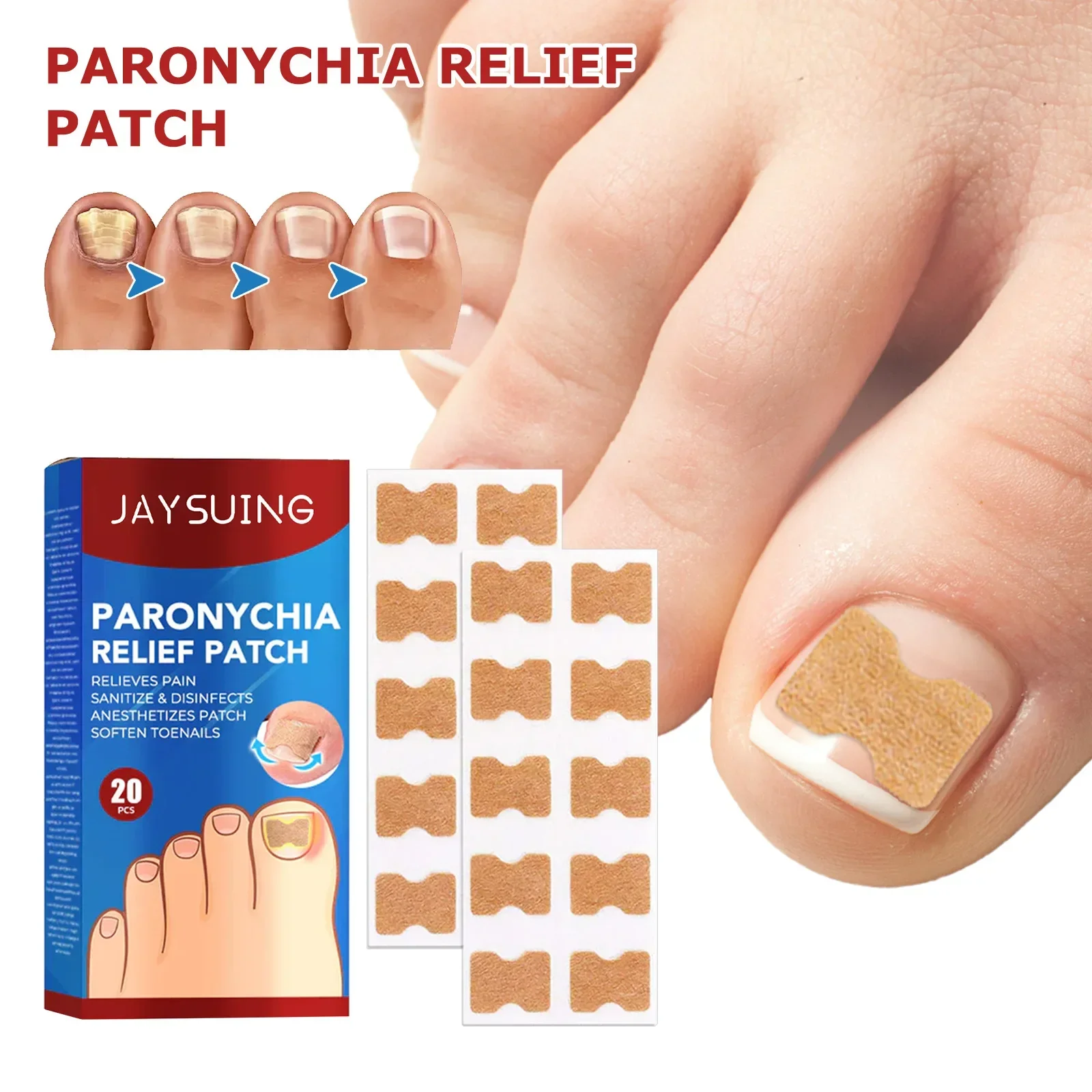 20pcs nail correction stickers ingrown toenail corrector patch waterproof paronychia treatment pedicure tool
