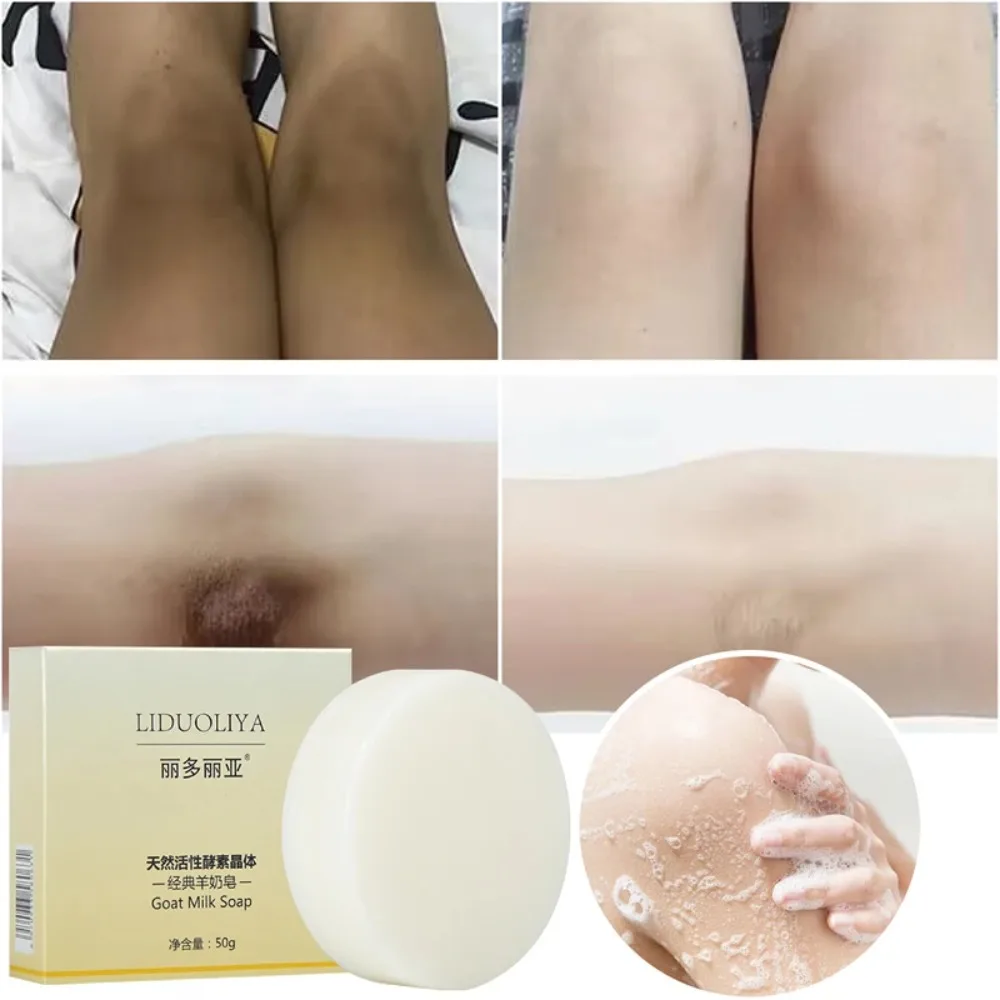 

Removal Dead Skin Body Whitening Soap Moisturizing Chicken Skin Removal Bleaching Soap Body Brighten Deep Clean