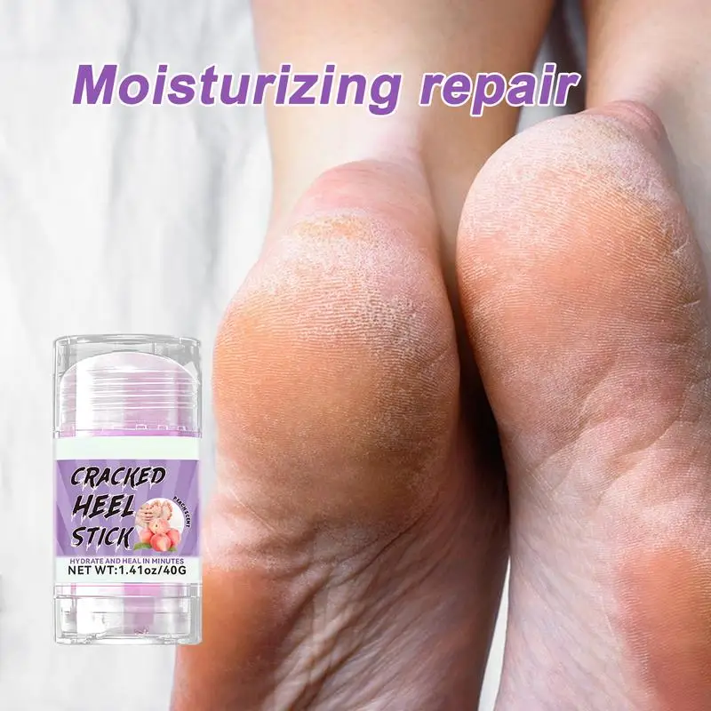 

Peachh Foot Cream Softening Dry Cracked Feet Gentle Exfoliation Foot Care Solution Dry Cracked Heels Feet Gentle Foot Care