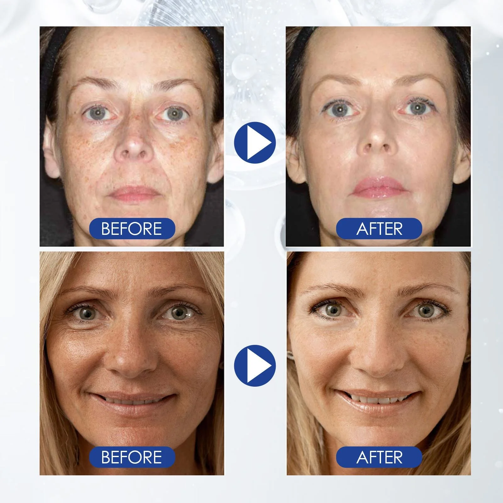 Rimpel Remover Gezicht Serum Anti Aging Lifting Verstevigende Vervagen Fijne Lijntjes Essentie Hydraterende Voedende Huidverzorging Koreaans_voghion.com