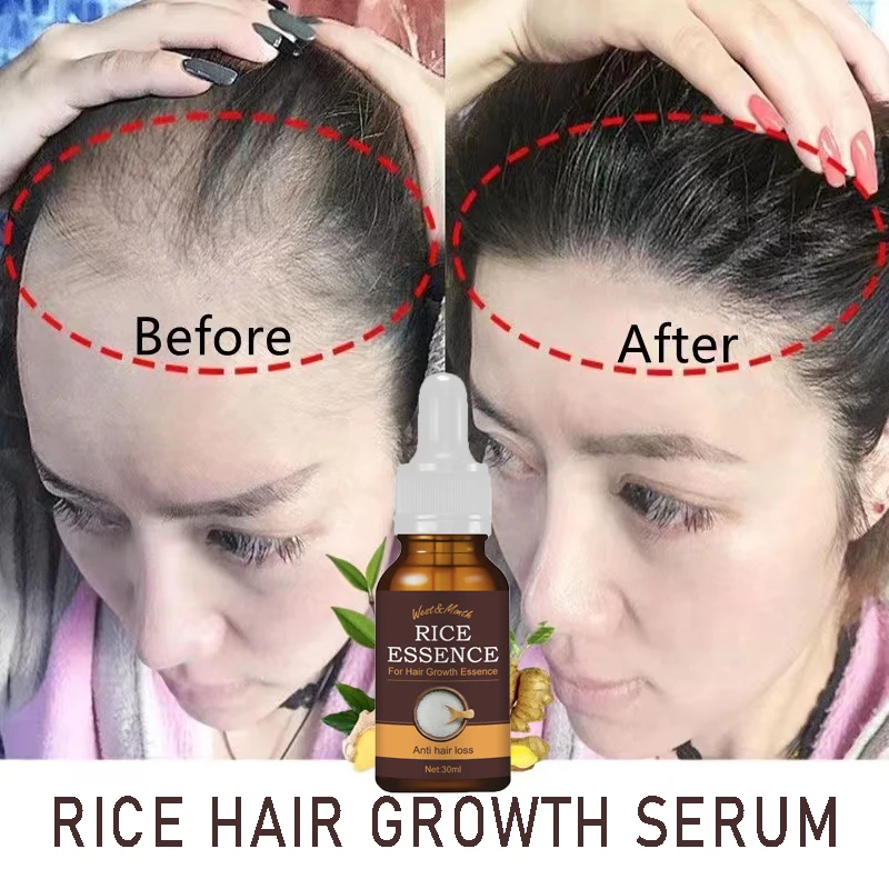 30ml Rice Hair Growth Serum Stop Hair Loss Oil Healthy Hair Thinning