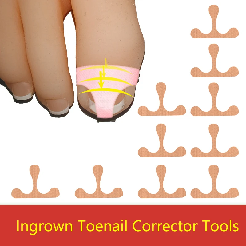 

T-Shaped Ingrown Toenail Correction Anti Paronychia Treatment Toe Nail Sticker Pedicure Foot Orthodontic Toe Nail Patches