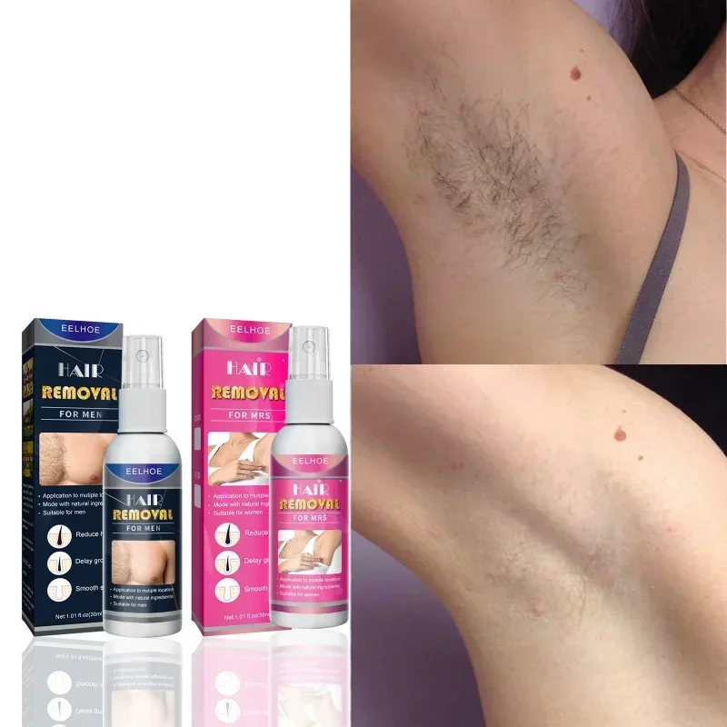 

Permanent Hair Removal Spray Painless Non-Irritating Hair Growth Inhibitor Armpit Leg Arm Hair Depilatory Cream for Men Women