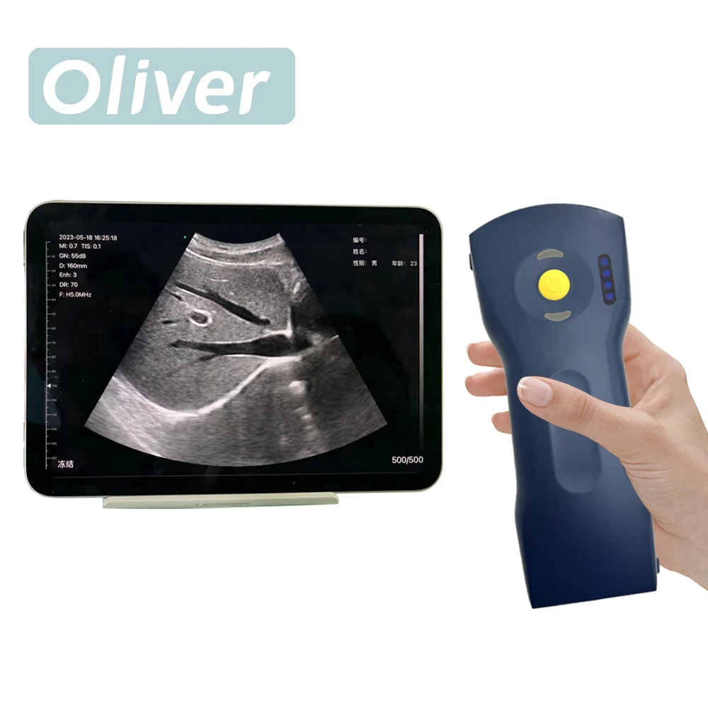 Sonda de ultrasonido inalámbrica de 256 elementos y 64 canales, escáner portátil con Wi-Fi, Doppler color, lineal y convexo 3 en 1