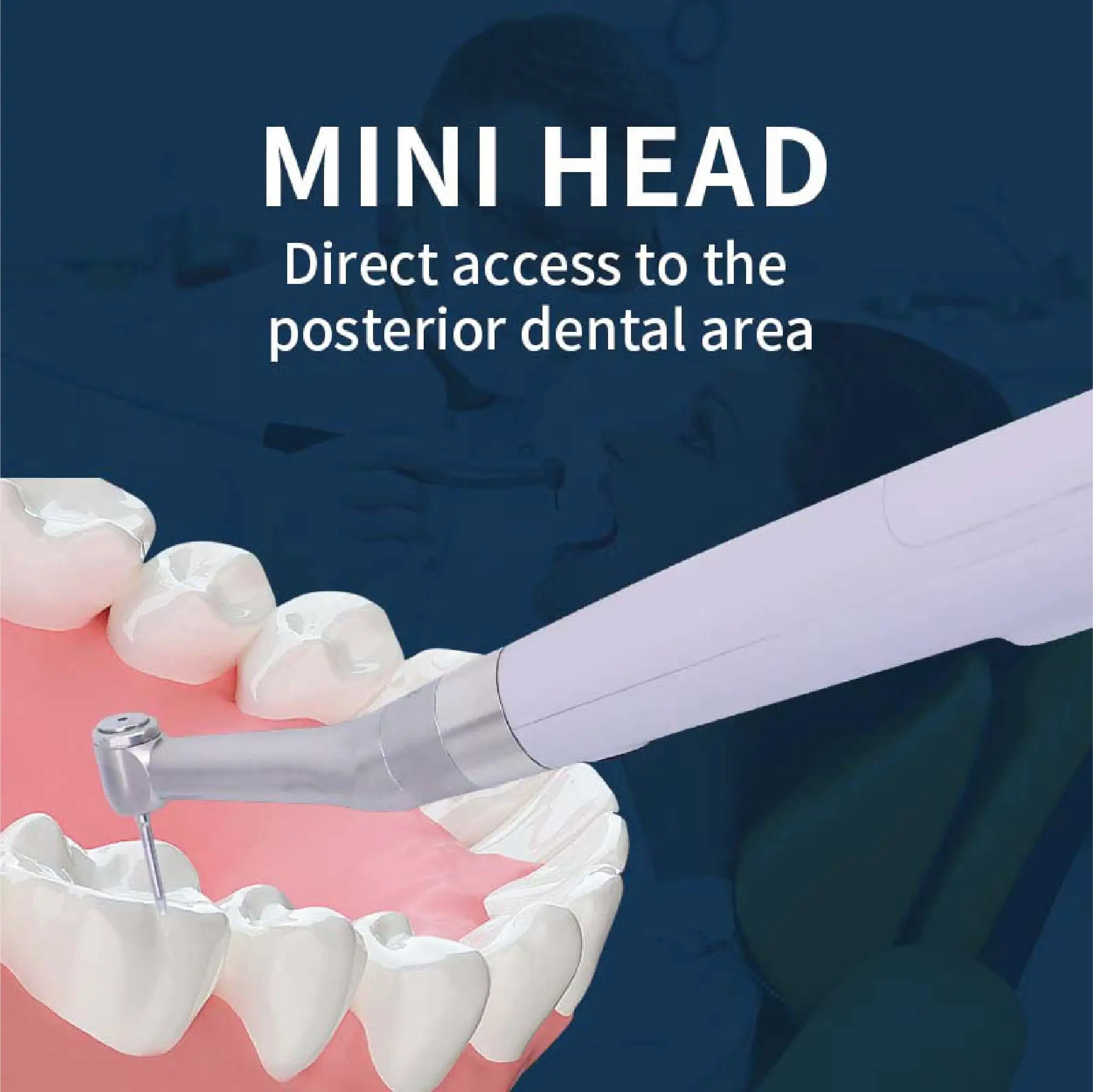Рисунок 5 - Система имплантации гаечных ключей