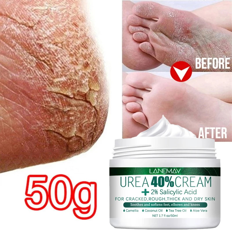 Herbal Anti Crack Foot Cream Heel Cracking Repair Products Exfoliation Dead Skin Removal Softening Moisturizing Hand Feet Care