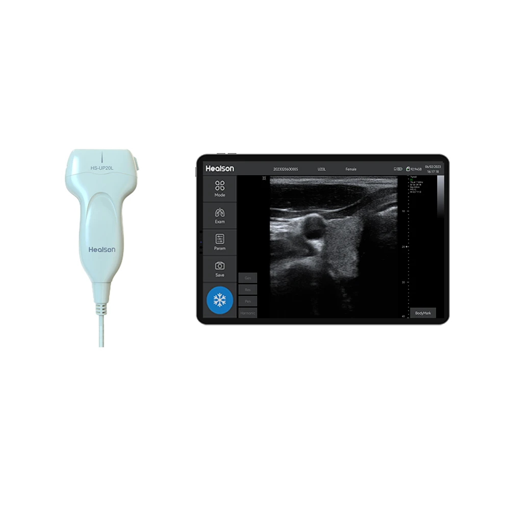Portable B/W Handheld Linear Scanner Ultrasound Probe Medical Instruments with Android Tablet Computer