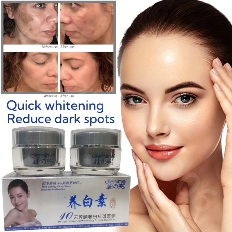 Anti-Pigment Face Whitening Cream Powerful Effects Whitening Anti Freckle Melasma Bleaching Remove Dark Spots Skin Care Products bleaching cream for dark skin intense top quality bleaching whitening cream for face neck hands and feet without side effects