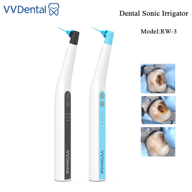 

VVDental Oral Sonic Irrigator Endo File Activator With LED and 60PCS Tips for Root Canal Cleaning Treatment Endodontic Cleaning
