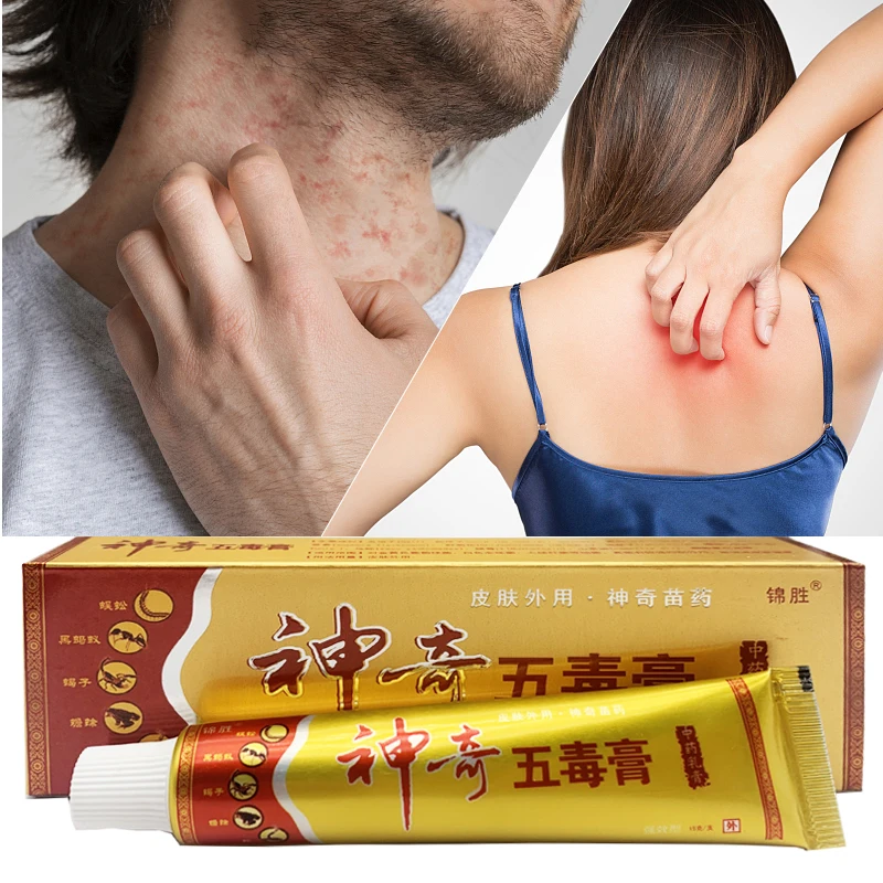 Psoriasis Cream Removal Eczema Dermatitis Against Products Eczematoid Skin Repair Antibacterial Care Herbs Dressing 15g Herbal Skin Care Cream