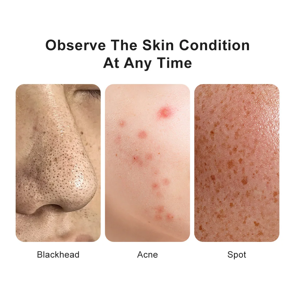 Digital Microscope Wireless Electron Dermatoscope Scalp Detection Pores Magnifier Facial Skin Analyzer Machine Professional