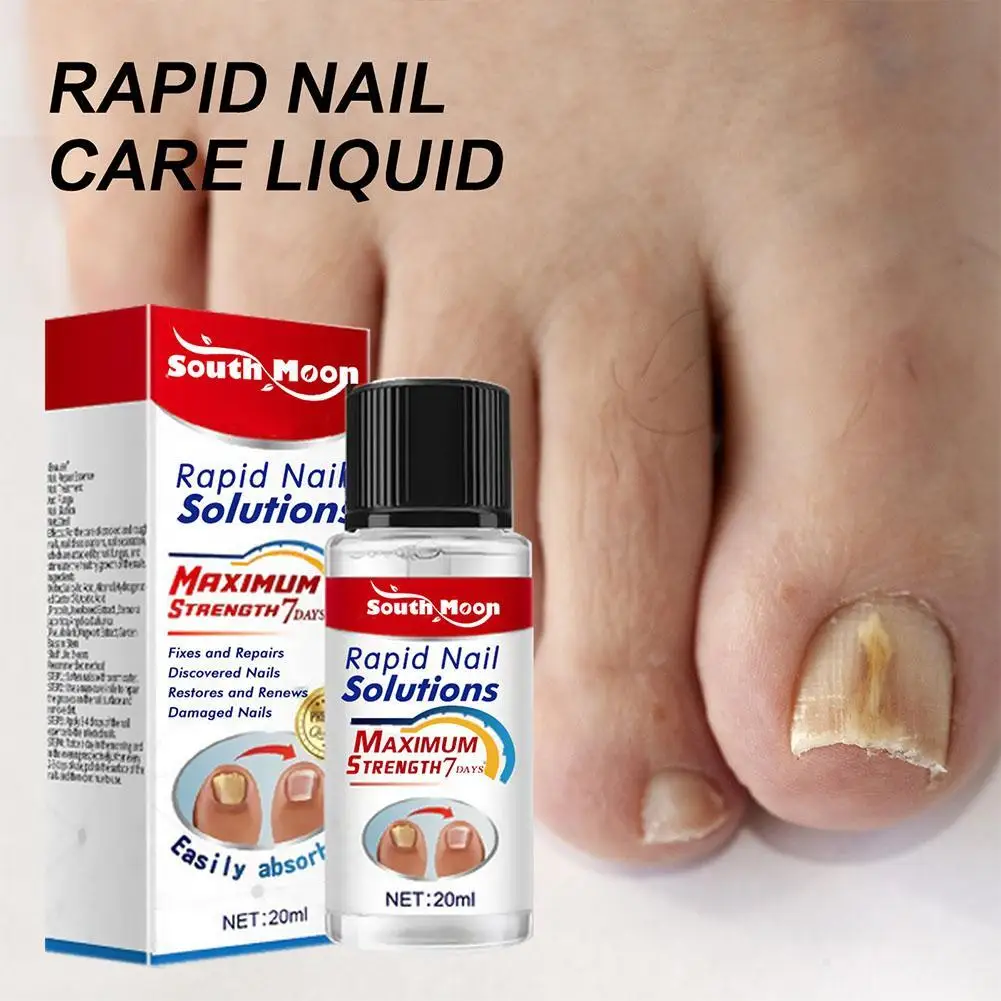 Nail Fungus Remover 20ml Nail Fungal Treatment Essence Oil Serum Repair Anti Infection Gel