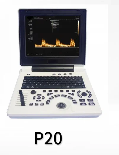 

Портативный PC черно-белый Super P20 с бородомным выпуклым зондом