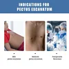 GHORTHOUD Rehabilitation Equipment Funnel Chest Orthopedic Brace Pectus Excavatum Brace Vacuum Bell Pectus Excavatum 3