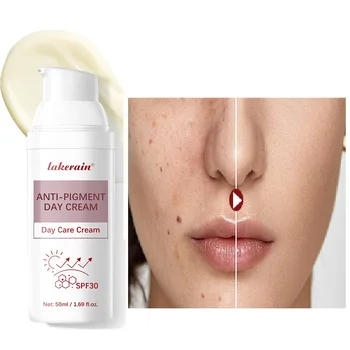 Crema da giorno anti-pigmento SPF 30 Schiarente Naturale Inibisce la melanina Sbiancamento e rimozione delle macchie Trucco per la cura della pelle del sole all'aperto 1