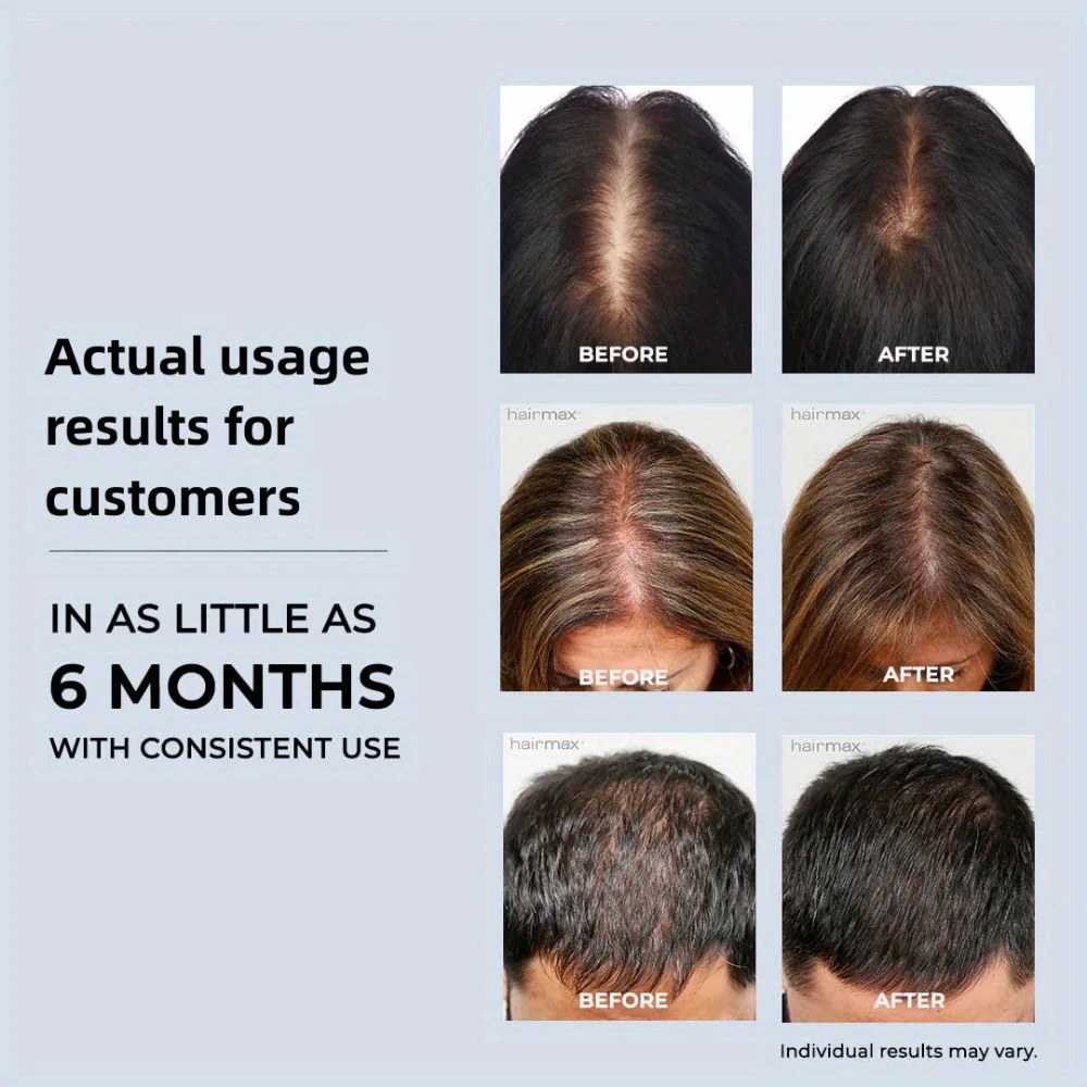 180LEDS 660NM&850NM Hair Regrowth Cap Reduces Oiliness Deep Into Hair Follicles Strengthen Hair Roots Relieves Fatigue Hat