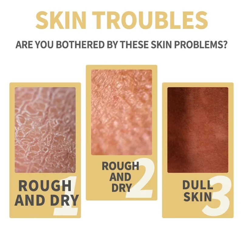 Yellow peeling oil exfoliating elbow knee Deep cleaning Bleaching fade Dark spots melanin brighten skin whiten Remove Dead skin whitening cream body scrub body peeling lotion
