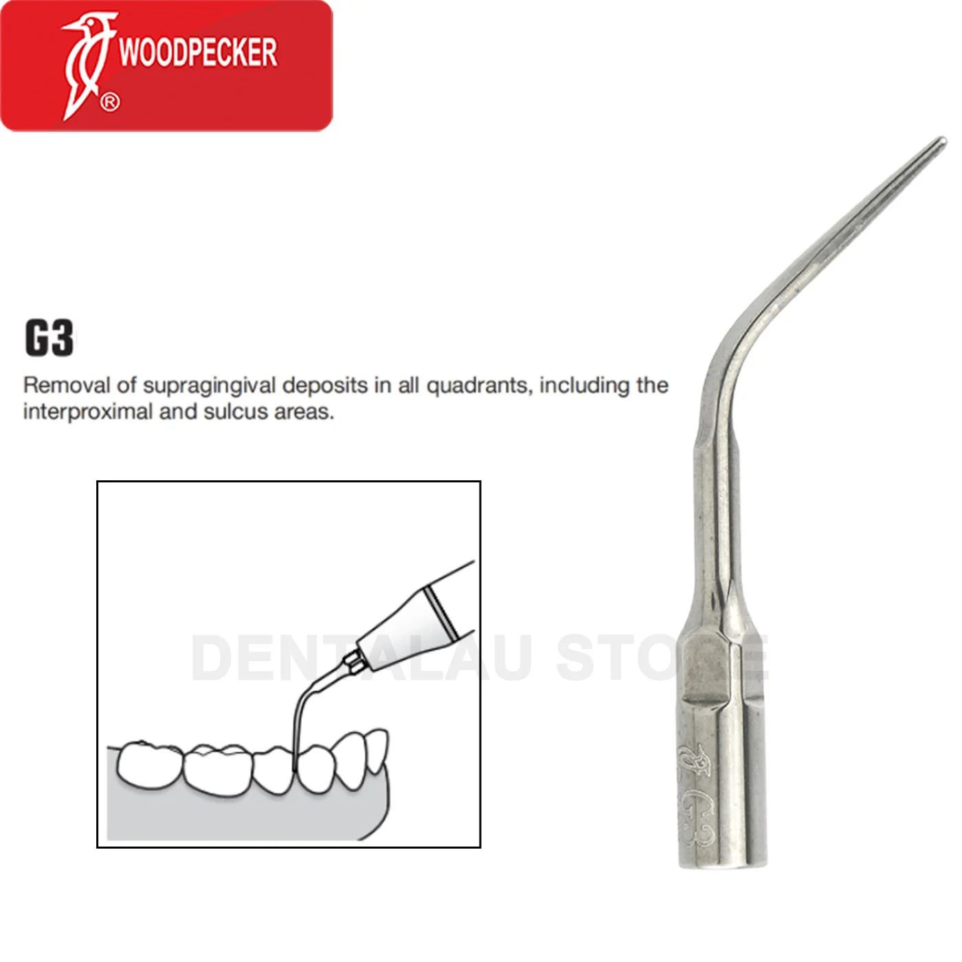 

G3 Woodpecker DTE Dental Ultrasonic Scaler Tips FIT Endodontics Periodontics EMS