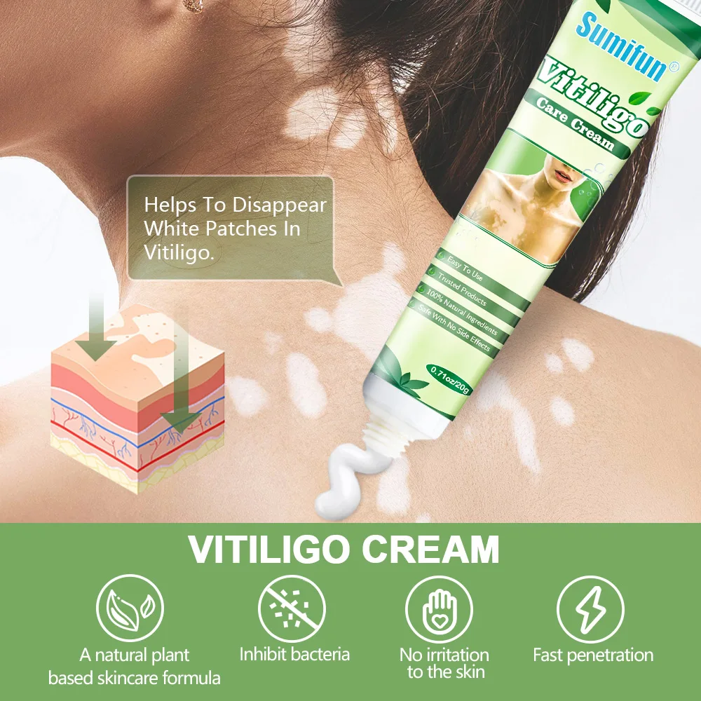10Pcs Sumifun Vitiligo Repair Cream White Spot Disease Treatment Ointment Localized Leukoplakia Nourishing Skin Chiense Medicine