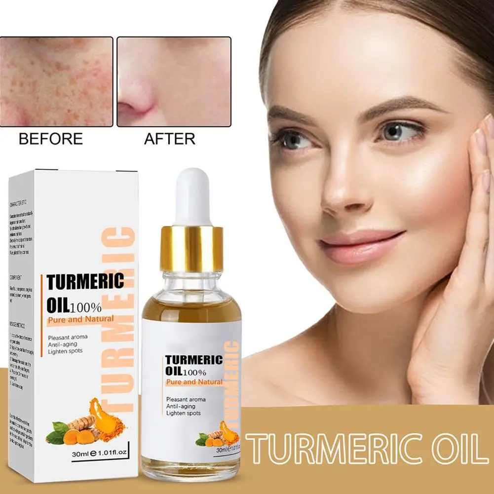 

30ML Turmeric Freckle Whitening Serum Fade Dark Spot Removal Pigment Correcting Facial Essence Beauty Face Skin Care