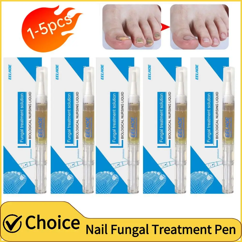 1/2/3/4/5PCS Nail Fungal Treatment Pen Onychomycosis Hand Foot Removal Repair Care Nti Infection Toe Fungus Treatment Serum