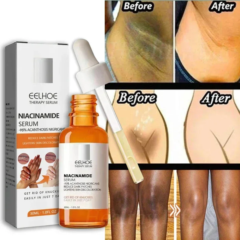 

Niacinamide Whitening Serum Dark Skin Private Parts Brightening Essence Intimate Areas Armpit Lightening Cream Body Skin Care