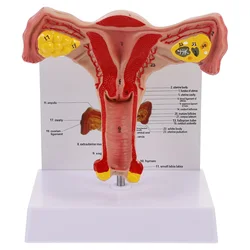 Modelo de anatomía de los órganos reproductores femeninos, modelo de útero para 1 unidad