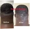 Razor Bumps stopper Cream, Beard , Head, Bikini Area 1