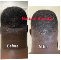 Razor Bumps stopper Cream, Beard , Head, Bikini Area 1