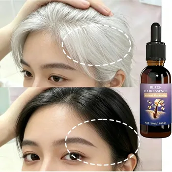 Essenza Nera Rinforzante per Capelli - Equilibra il Sebo del Cuoio Capelluto e Sblocca i Follicoli, Migliora la Lucentezza dei Capelli