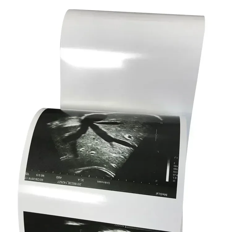 Thermal Paper 10 Roll Compatible Ultrasound Printing Paper Sony thermal paper,printing paper,thermal paper roll,thermal printer paper
