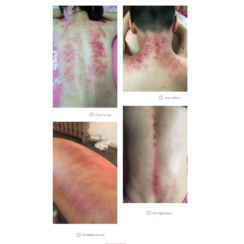 Correct Cervical Vertebra Lumbar Traction Straight Spine Spine Relax Back Massage Board Brace Back Stretching Device Health Care