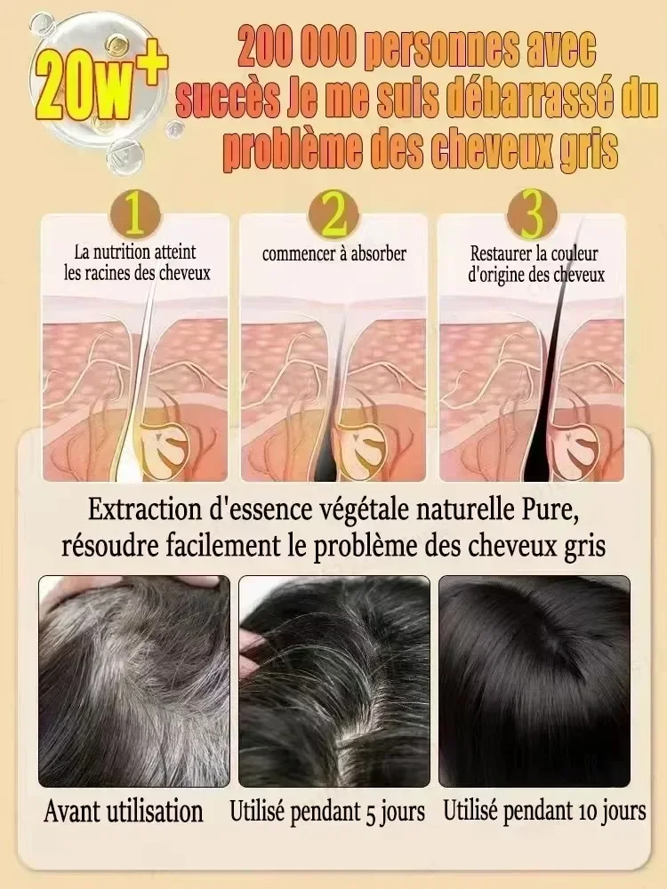 Hair Treatment Turn White Hair into Black Remove Gray Hair in 7 Days