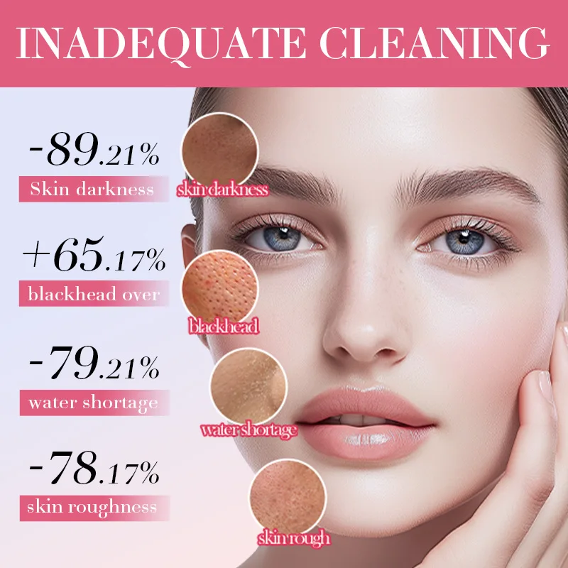 SADOER Watermelon Niacinamide Facial Cleanser Deep Cleansing Moisturizing Face Wash Foam Cleanser Face Cleansing Skin Care 2