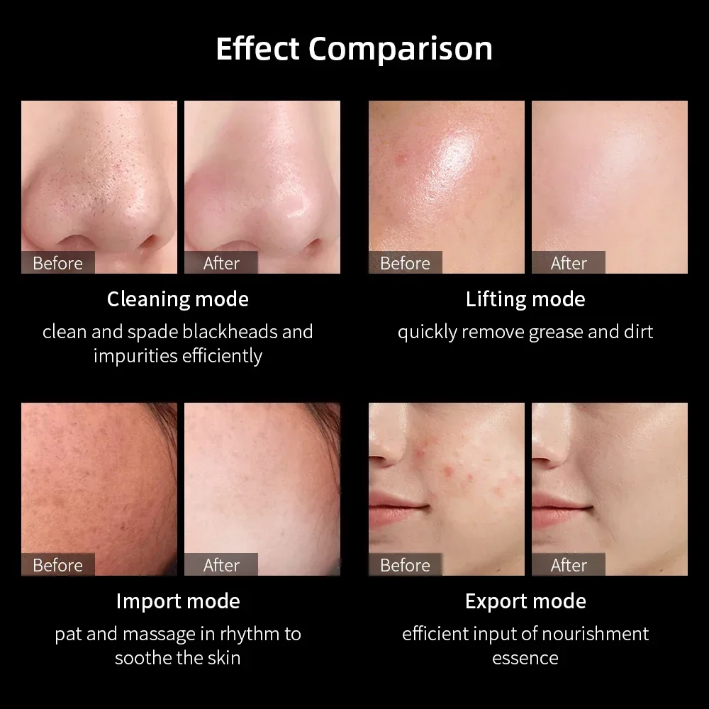 Ultrasonic Vibration Blackhead Remover Deep Cleansing Face Skin Scrubber Pore Cleaner Lifting Facial Machine