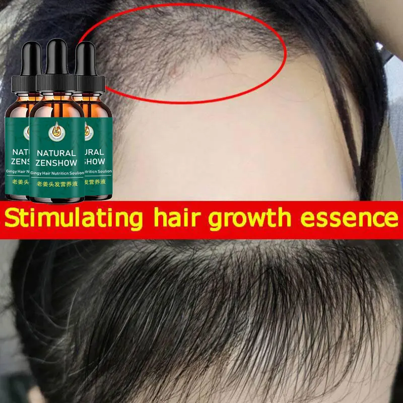 Ginger Hair Growth Serum Conditioner Anti-Hair Loss Essential Oils Improves Hair Follicles Nourishes Hair Roots Thick Hair